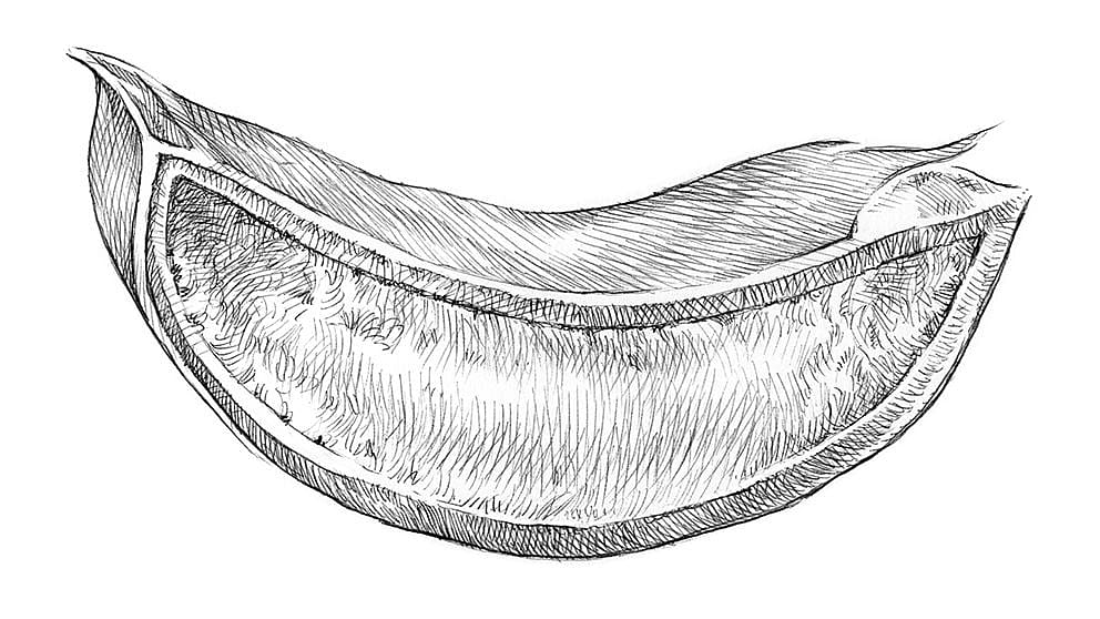 rastlina